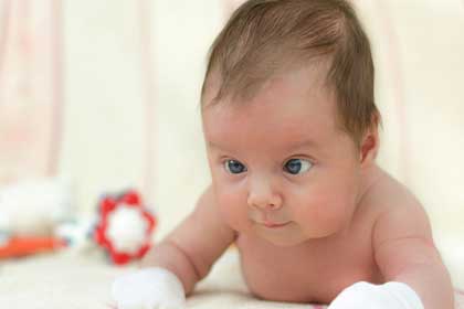 پیشگیری از چپ شدن چشم نوزاد